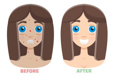 Lazer peeling önce ve sonra simge