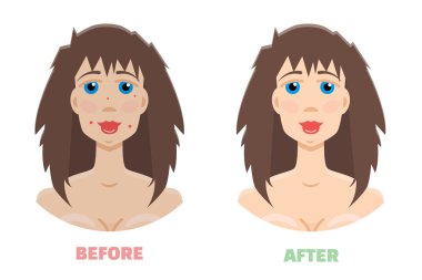 Kozmetik peeling kavramı