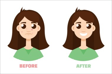 Akne GIR önce ve sonra