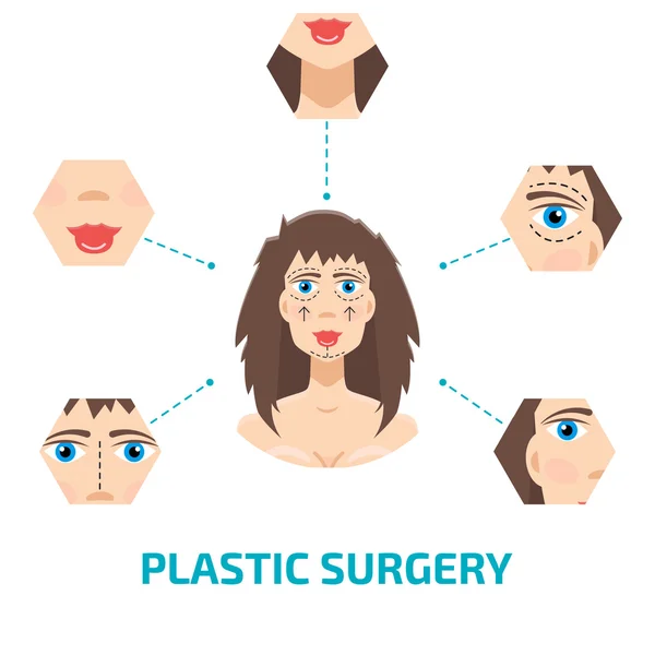 Cirurgia plástica infografic —  Vetores de Stock