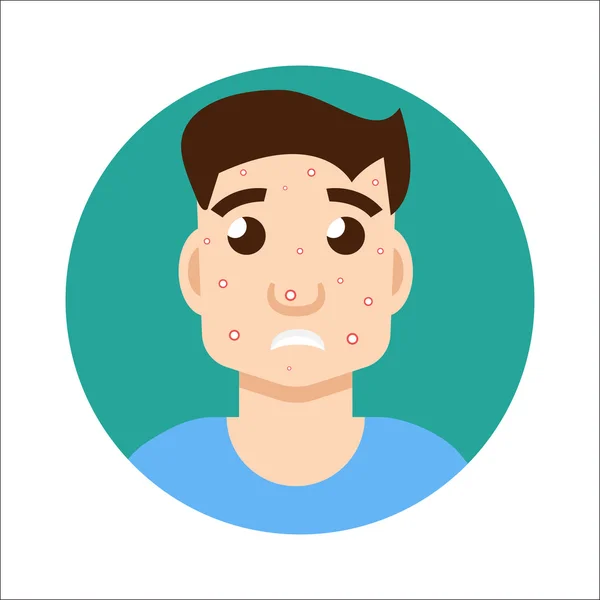 Acne homem ilustração — Vetor de Stock