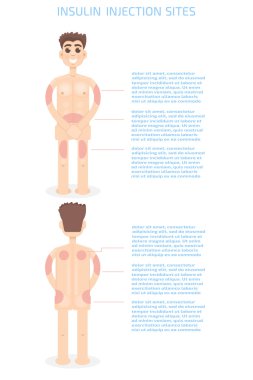 Injection sites infographics clipart