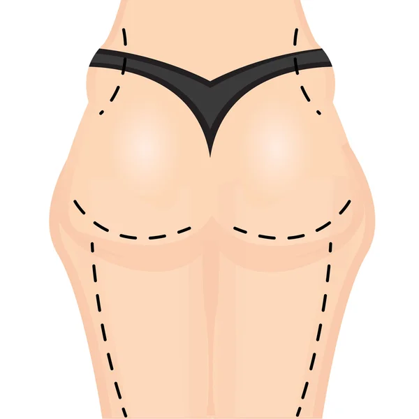 Icône de liposuccion dessin animé — Image vectorielle