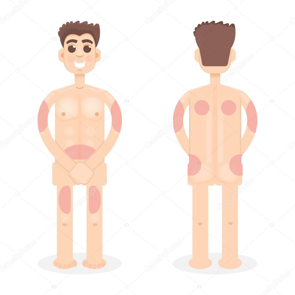 Insulin Injection Sites Vector Image By C Ansim Vector Stock