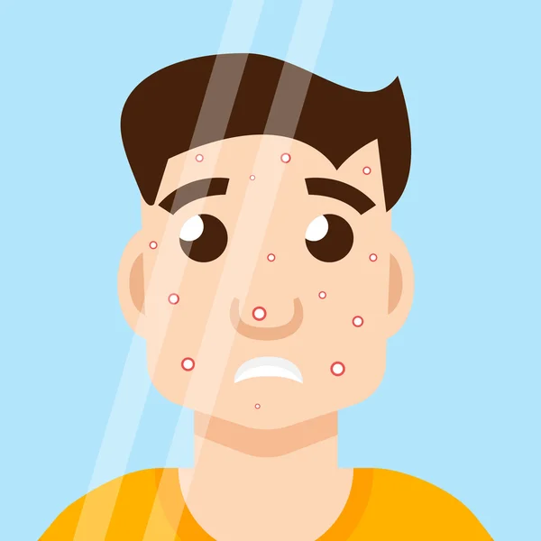 Volwassen acne man — Stockvector