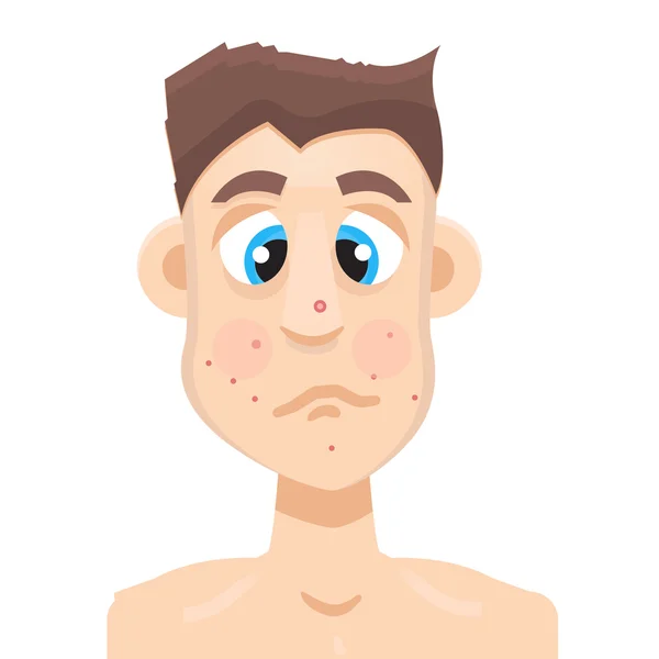 Volwassen acne man — Stockvector