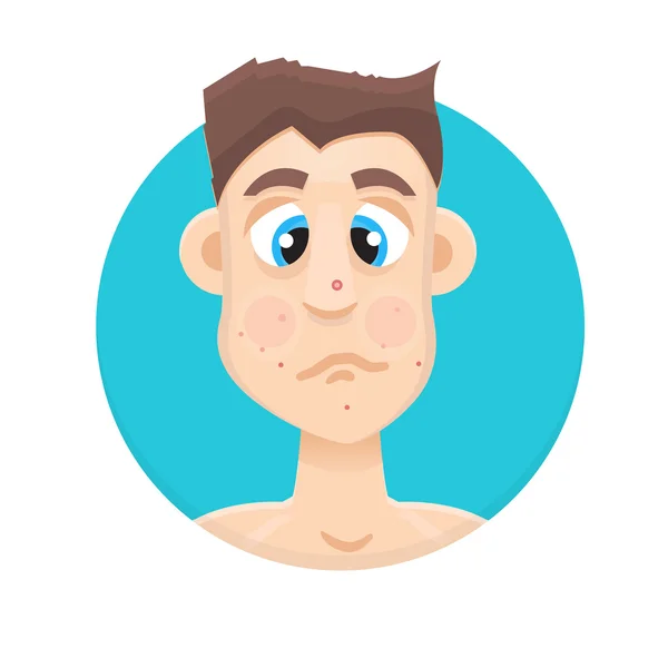 Adulte acné homme — Image vectorielle