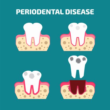 Periodontal disease icons clipart