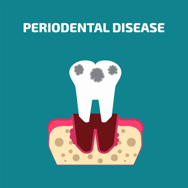 Icona della malattia parodontale — Vettoriale Stock