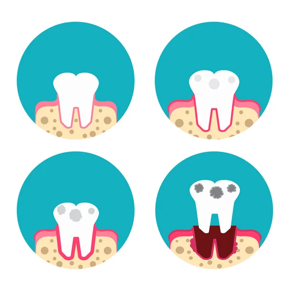 Iconos de la enfermedad periodontal — Vector de stock