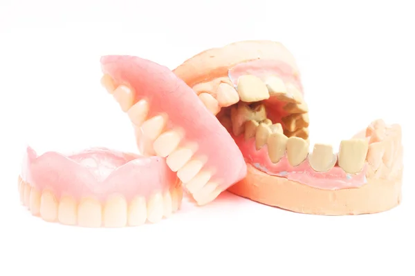 Denture isolated on white — Stock Photo, Image