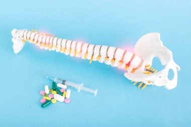 A model of the spine on a blue background near which there are pills and injections. Concept of treatment of degenerative diseases of the spine with drugs and pills, chondroprotectors and pain clipart