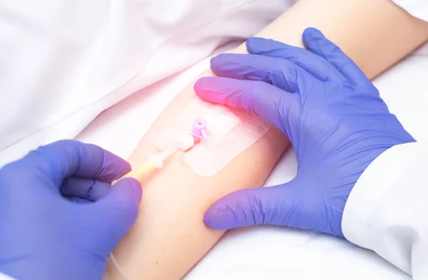 Medico che inserisce un catetere endovenoso per trasfusione di sangue in un paziente, primo piano. Donazione di sangue — Foto Stock