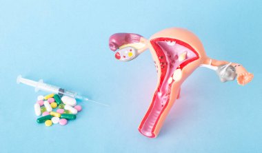 Dişi üreme sisteminin bir kopyası ve mavi arka planda bir sürü hap ve enjeksiyon. Genital enfeksiyonların, antibiyotiklerin, trikomonezin uyuşturucu tedavisi kavramı