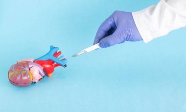 Doctors hand with a scalpel near a mock-up of a human heart on a blue background. The concept of modern cardiac surgery. Copy space for text, heart disease