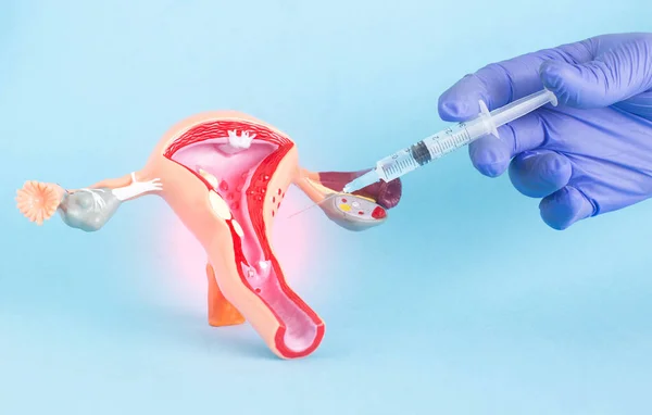 Doctor Plastic Surgeon Syringe Background Model Female Genital Organs Concept — Fotografia de Stock