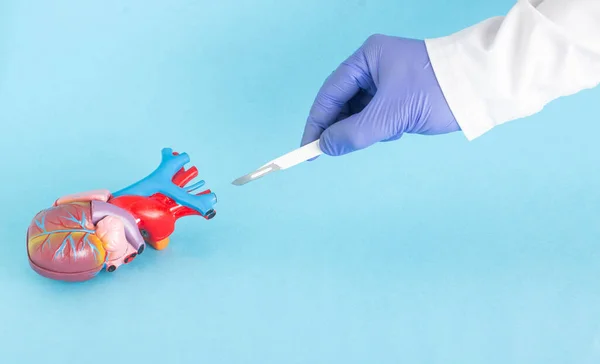 Doctors hand with a scalpel near a mock-up of a human heart on a blue background. The concept of modern cardiac surgery. Copy space for text, heart disease — Stockfoto