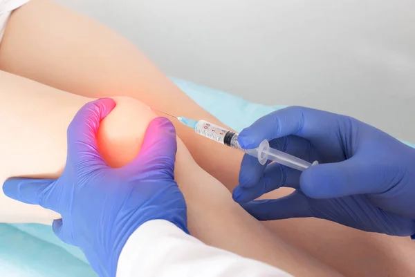 Doktor dizinde ağrı ve artrosis olan bir hastanın diz eklemine hiyalüronik asit enjekte ediyor. Chondroguardlarla ortak tedavi kavramı