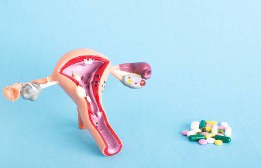 Kadın üreme sisteminin mavi arka planda haplı modeli. Jinekolojik enfeksiyonlar için antibiyotik tedavi konsepti. Doğum kontrol hapları, kürtaj