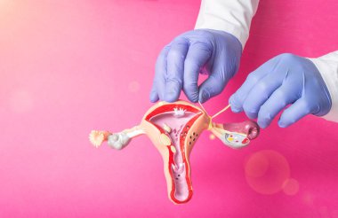 Doktor jinekolog, dölyatağı borularını kadın üreme sisteminin dizilişine bağlıyor, pembe arka plan. İstenmeyen hamilelik için doğum kontrol kavramı, metin için kopyalama alanı, prosedür