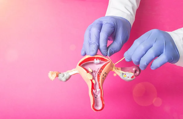 Läkare Gynekolog Ligates Äggledarna Exemplet Med Utformningen Det Kvinnliga Reproduktiva — Stockfoto