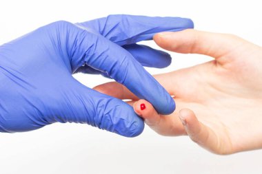 Mavi eldivenli doktor beyaz arka planda hastanın parmağından kan alıyor, yakın plan. Glikoz, hemoglobin ve plazma için kan alma kavramı