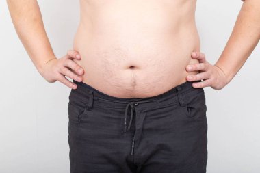 Beyaz bir arka planda şişman ve sarkık bir göbeği olan bir adam. Obezite ve obezite kavramı, yanlış yaşam tarzı, fazla kilolu.