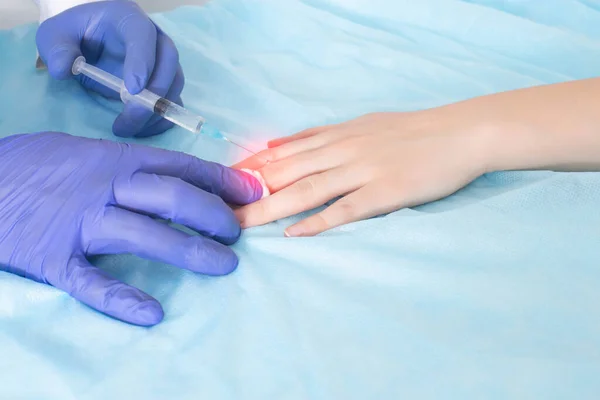 의사는 관절에 관절염 생기도록 손가락 관절에 주사를 놓는다 스테로이드를 주사에 — 스톡 사진
