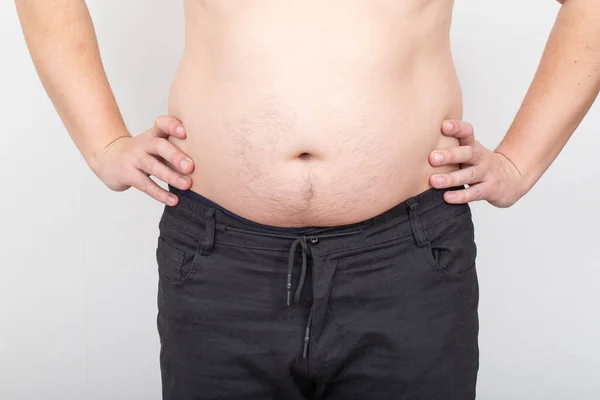 Ένας Άντρας Χοντρή Και Πλαδαρή Κοιλιά Λευκό Φόντο Παχυσαρκία Και — Φωτογραφία Αρχείου