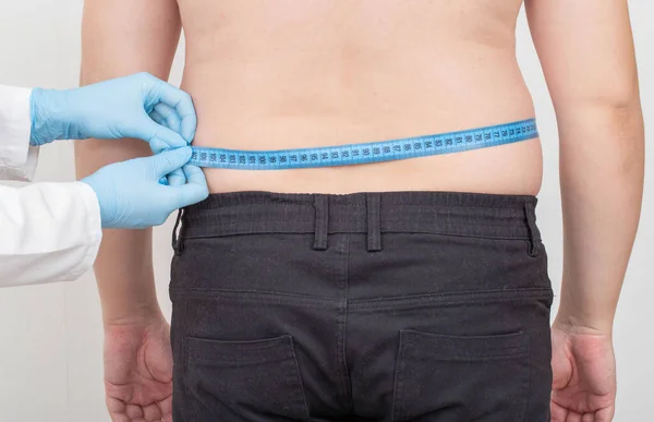 Doctor nutritionist measures the big fat belly of a male patient with a measuring tape. Weight loss and healthy lifestyle concept