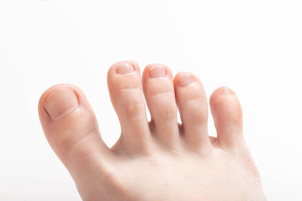 Toes on a white background. Concept of unpleasant foot odor, bacteria and fungus between the toes, sickness
