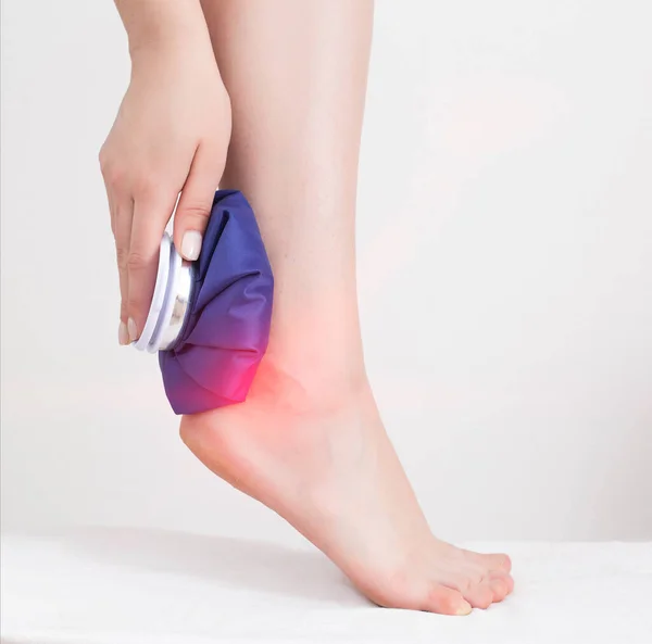 The girl applies a medical ice bag to the ankle joint to eliminate pain and relieve swelling. Cold joint treatment, inflammation