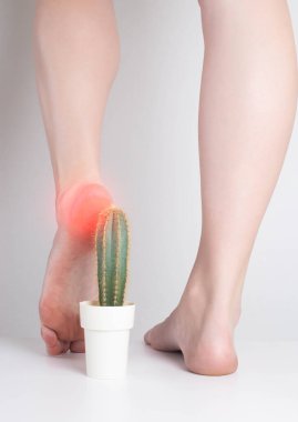The girl steps on the cactus with her foot. The concept of pain in the sole and heel, metabolic disorders, gout clipart