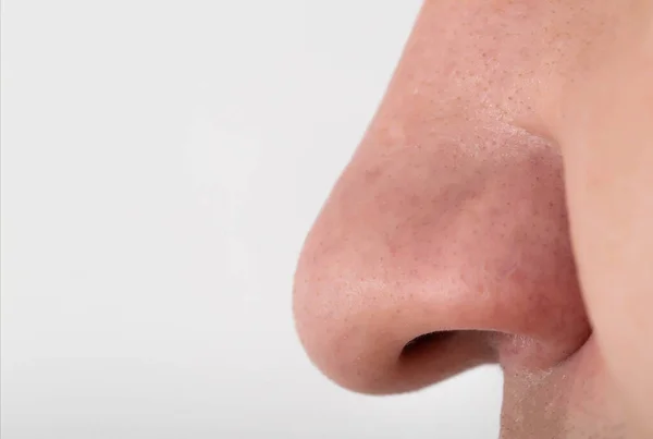 Человека Широкий Мясистый Большой Нос Крупный План Концепция Пластической Хирургии — стоковое фото