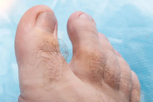 Hairiness on the toes of a person, macro. Hygiene and cosmetology concept, hair removal — Stock Photo, Image