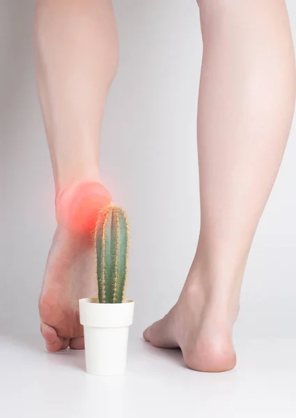 The girl steps on the cactus with her foot. The concept of pain in the sole and heel, metabolic disorders, gout — Stock Photo, Image