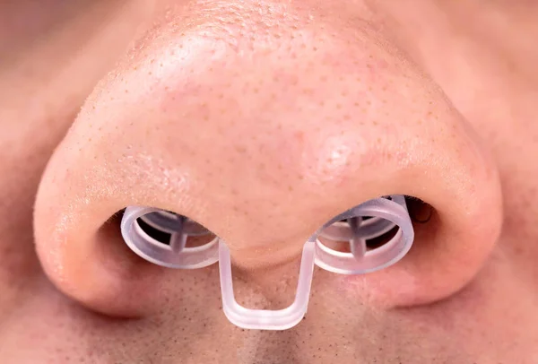 Un dispositivo contro russare in un naso di persone, primo piano, macro. Problemi di sonno — Foto Stock