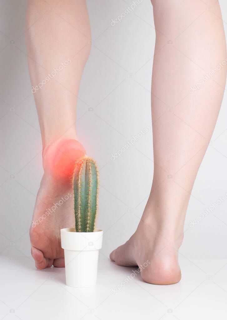 The girl steps on the cactus with her foot. The concept of pain in the sole and heel, metabolic disorders, gout