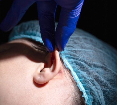 Estetik cerrah, kadın bir hastanın kulaklarını düzeltmek için ameliyat eder. Otoplasti, dışarı fırlayan kulakların elenmesi, estetik ameliyat