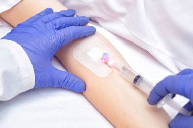 Doktor, kadın hastanın venöz kateterine şırıngadan ilaç enjekte ediyor. Ağrı kesici, iltihap önleyici, damar genişletici. Damardan.