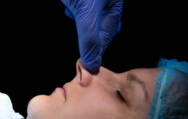 鼻中隔の矯正 女性患者の鼻の形の欠陥 整形外科の鼻形成術とセプトプラスチックへの外科的介入 — ストック写真