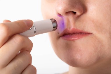 Kırışıklıkların tedavisi ve yüzünde lazer kalemle sorun olan deri. Kırmızı akne, makro, kozmetik uzmanı çıkarılıyor.