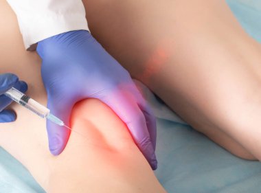 Klinikteki bir doktor diz ekleminin altındaki tibiyal sinirleri tıkamak için bir prosedür uyguluyor. Diz nakli ve diz hastalıklarının tedavisi için Kotsnept ağrı kesici, yakın plan.