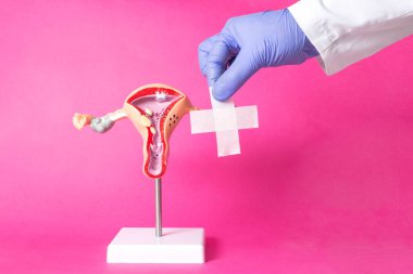 Doktor, pembe arka planda dişi üreme sisteminin planının yakınında tıbbi bir yara bandı tutuyor. Kadınlar için cerrahi ameliyat kavramı, yakın plastikler, dudakların düzeltilmesi. Metin için alanı kopyala