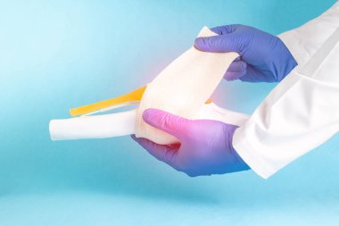 Doktor mavi bir arka planda sahte diz eklemine elastik bir bandaj sarar. Diz kırığı konsepti, çapraz bağ zedelenmesi. Orta yan bağ dokusu