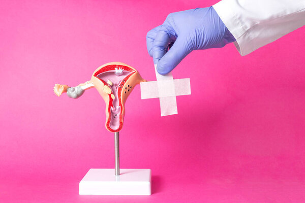 Doctor holding a medical plaster near the layout of the female reproductive system on a pink background. Concept of surgical operations for women, intimate plastics, correction of the labia. Copy space for text