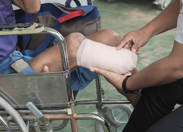 Elastic bandaged below knee amputation for prosthesis
