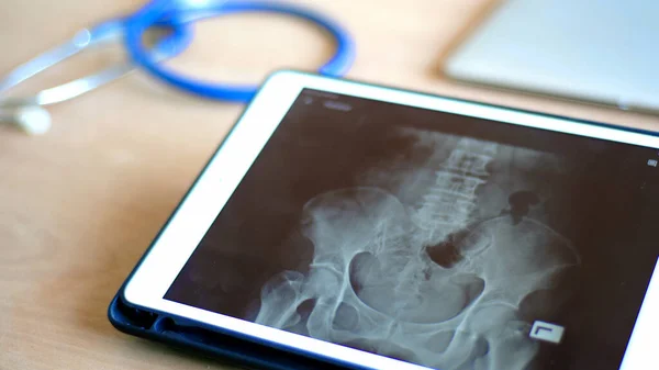 Arzt Nutzt Intelligentes Gerät Zur Ansicht Von Röntgenbild Und Diagnose — Stockfoto