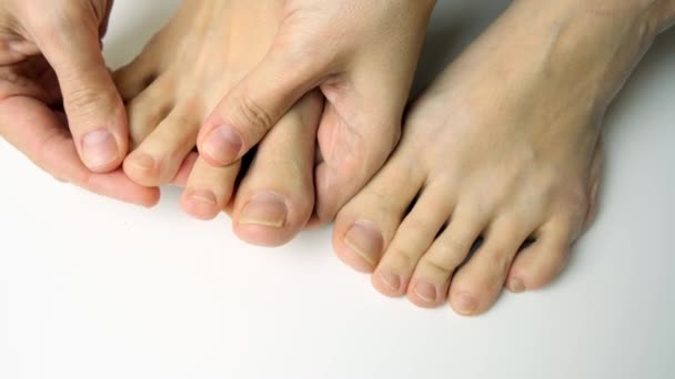 Une femme examine ses pieds pour détecter un champignon et une dermatite — Video