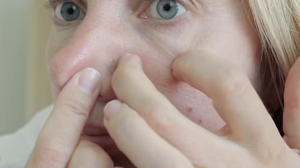 Vrouw Onderzoekt Haar Fase Zoek Naar Puistjes Een Spiegel Persen — Stockvideo